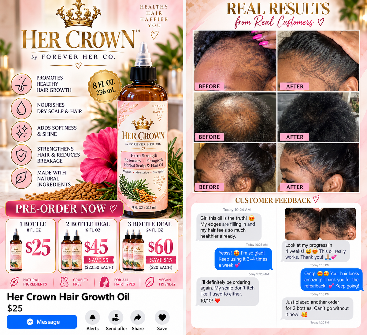 Preorder- HER CROWN Extra Strength Hair & Scalp Oil